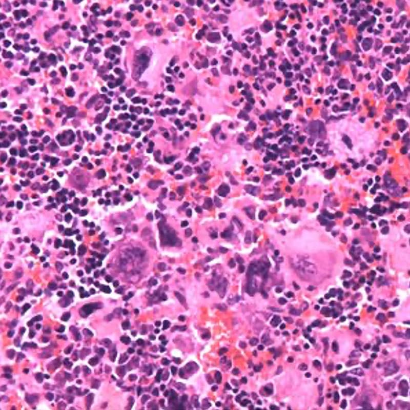 Hematoxylin and eosin staining of Dnm2Plt–/– spleens displaying megakaryocyte hyperplasia.