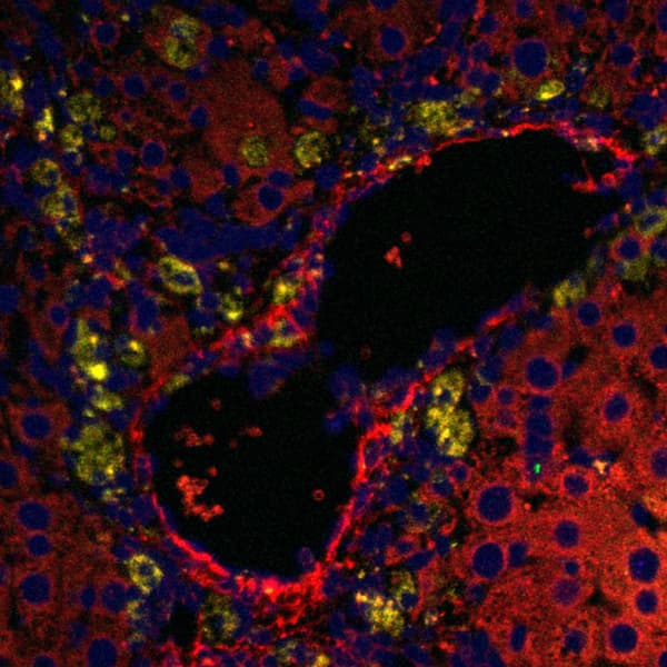 in-situ hybridization@liver