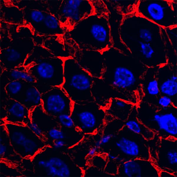 Phalloidin staining in liver tissue